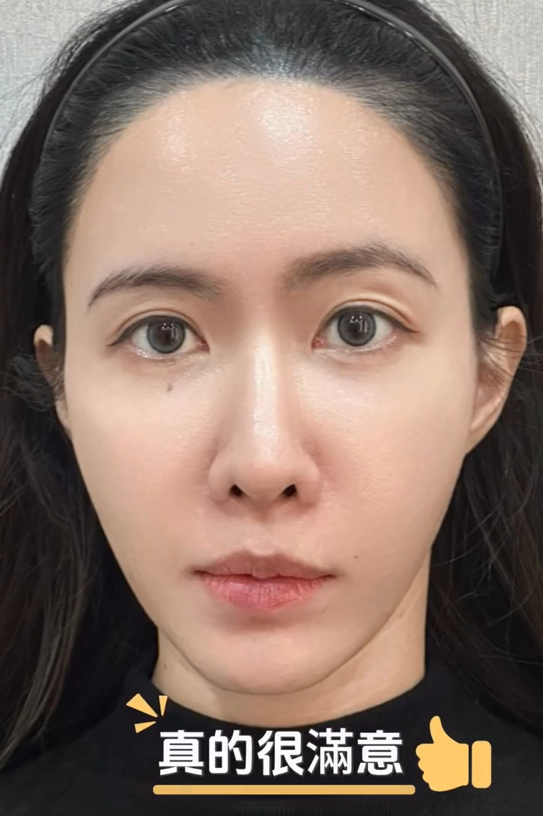 Dora10.jpg