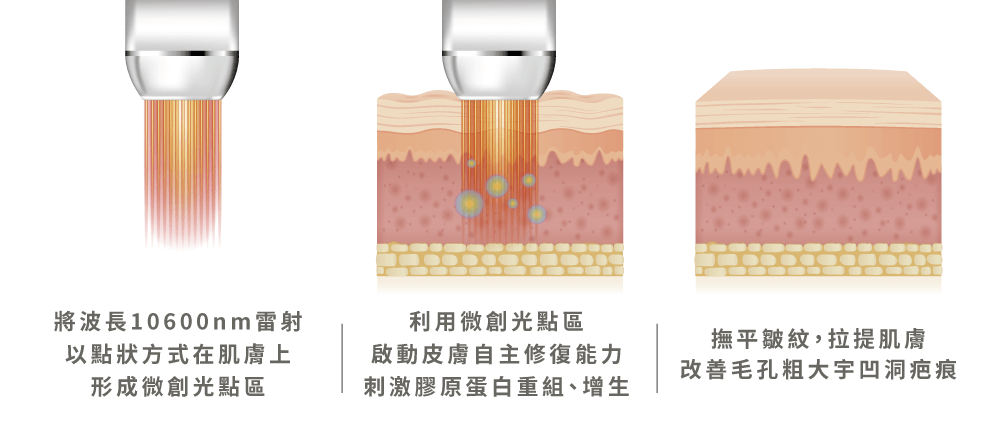 波長雷射