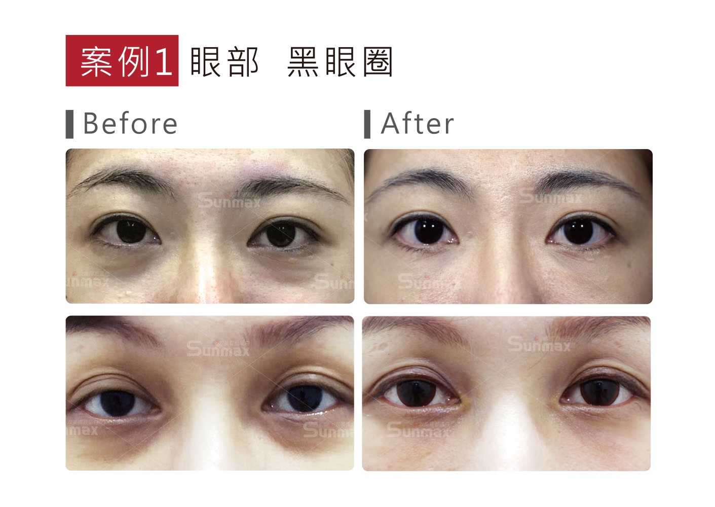 容積式加熱