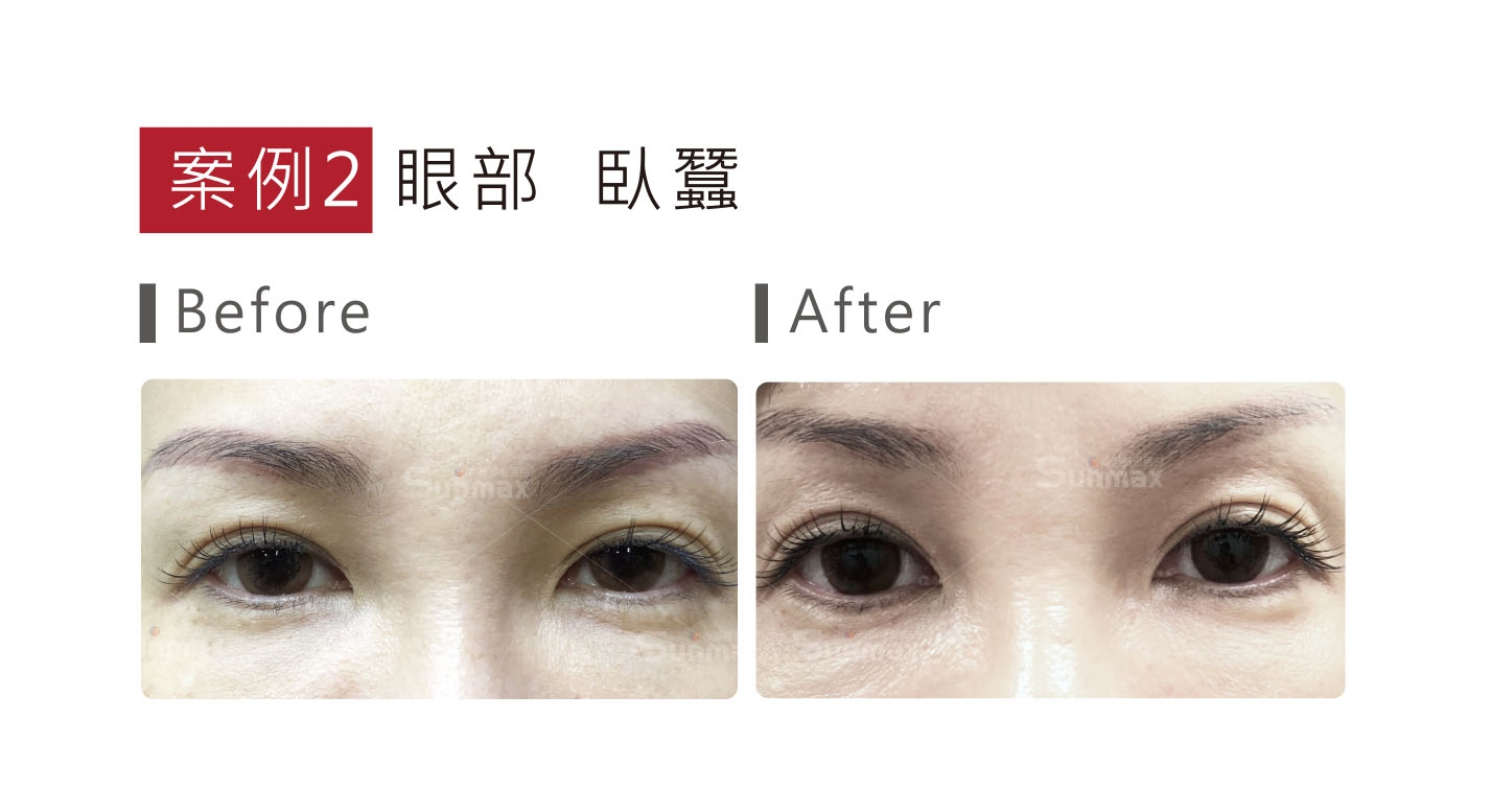 可調式智冷系統