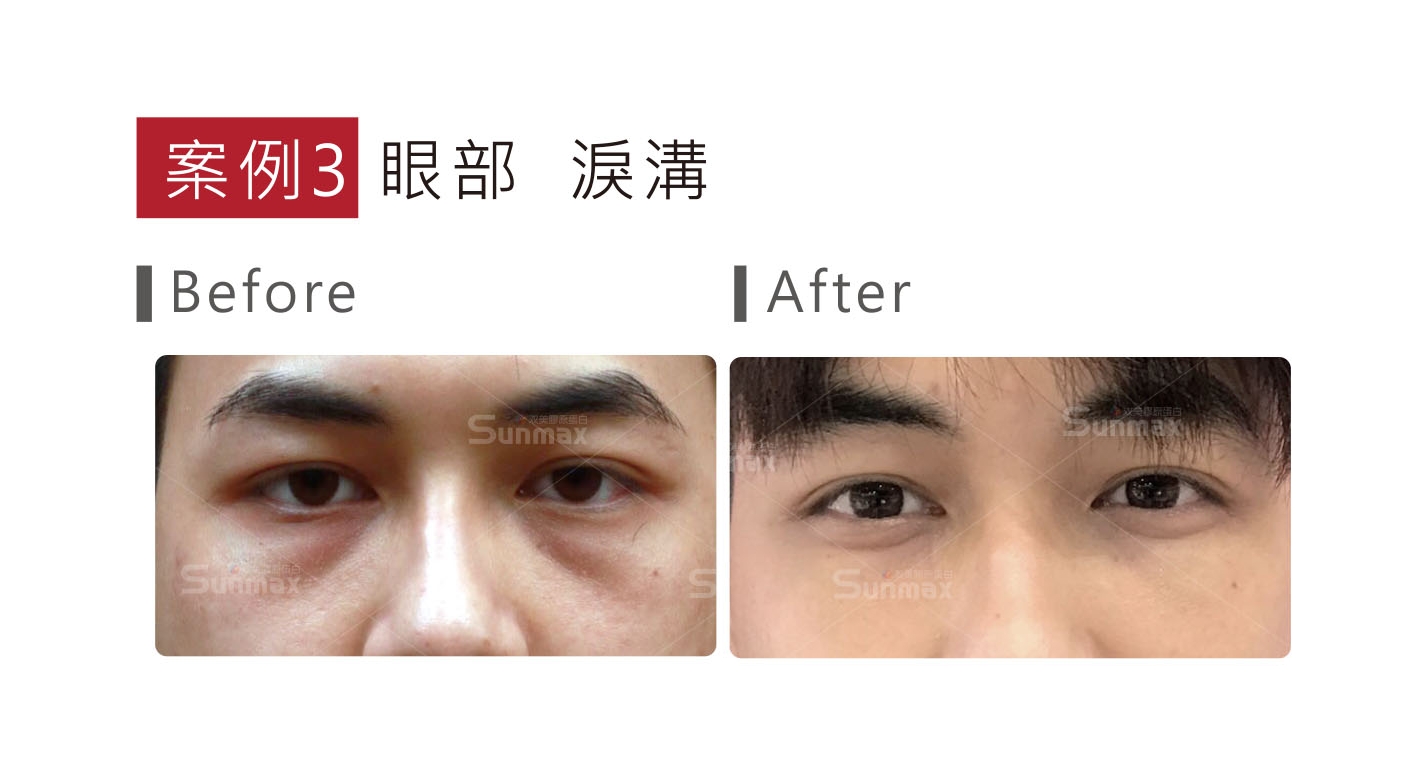 可調式智冷系統