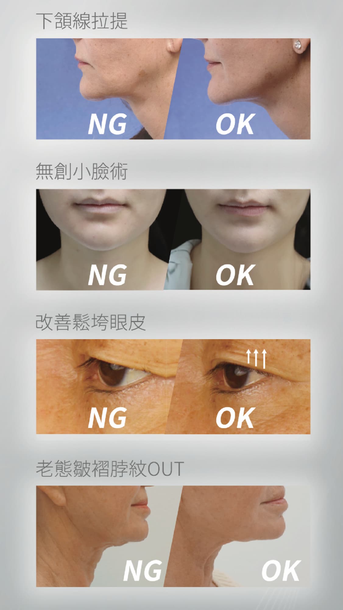 索夫波案例