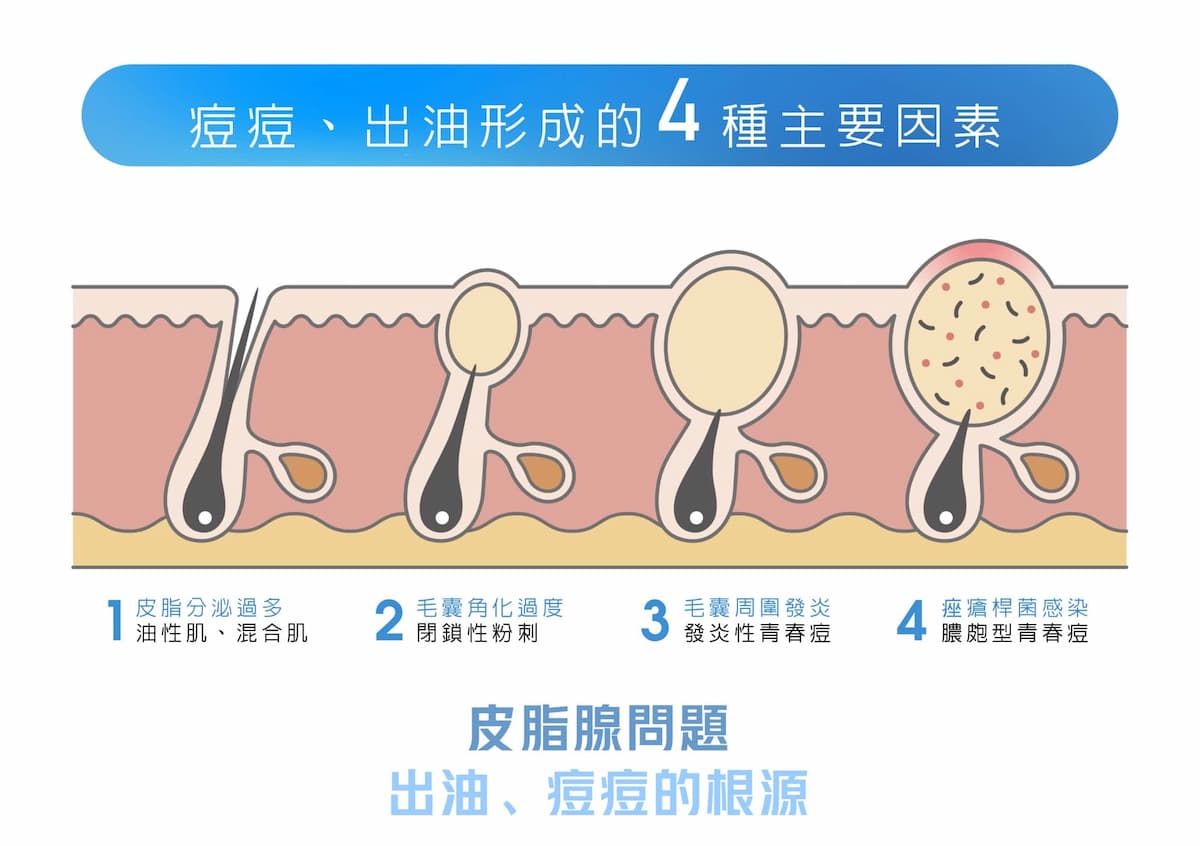 容積式加熱